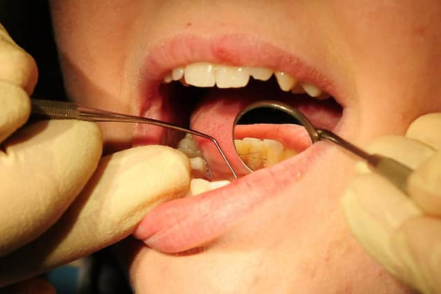 More Than A Quarter Of People In Bedfordshire Struggle To Get An Nhs Dentist Appointment